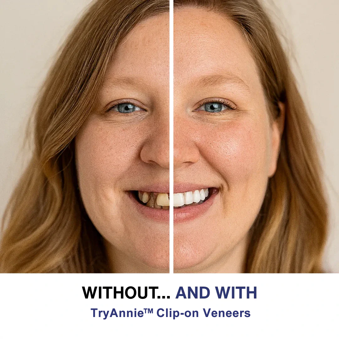 TryAnnie™ Clip-on Veneers
