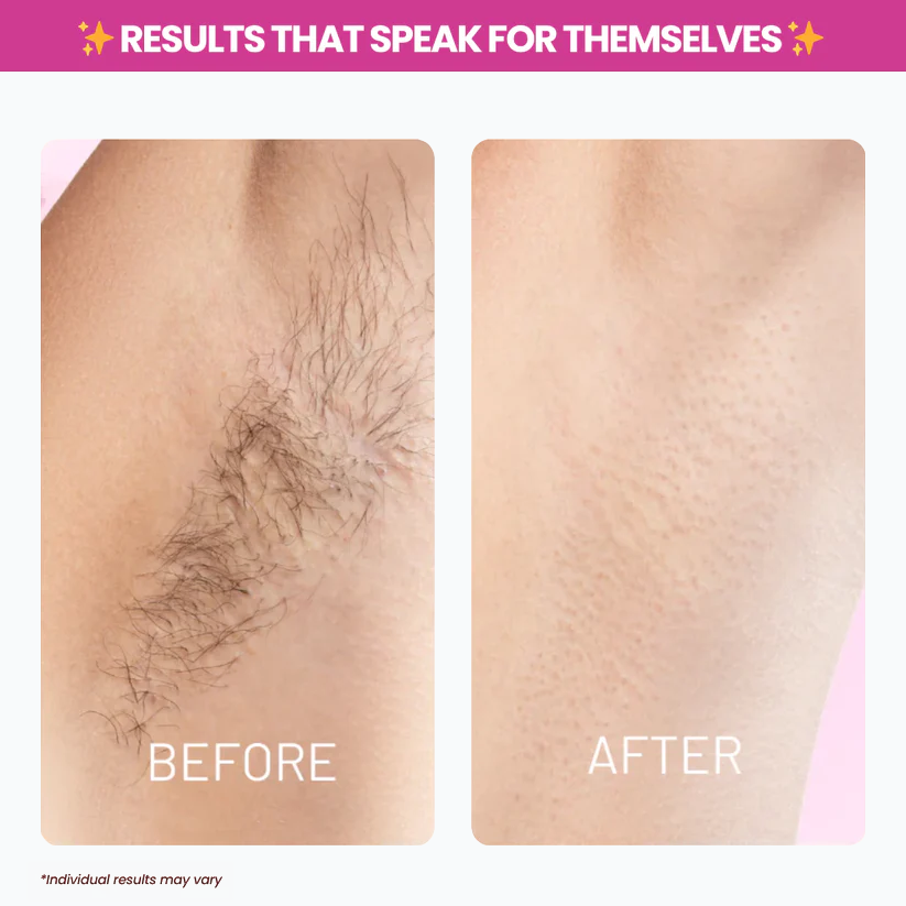 TryAnnie™ Cyperus Rotundus Oil