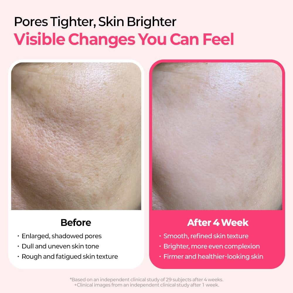 Pore & Spot Care Duo