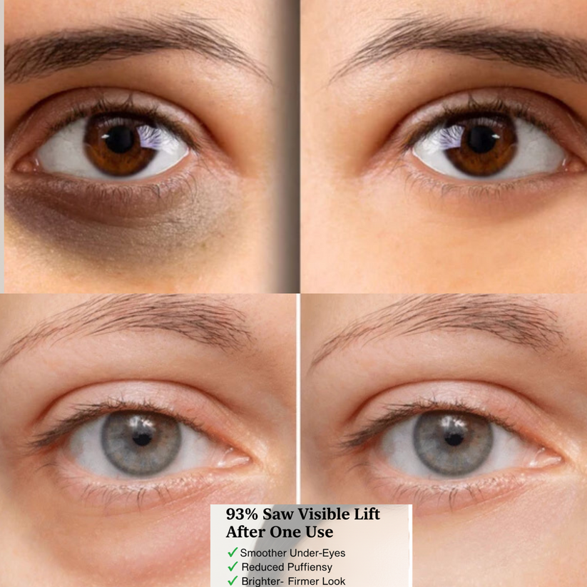 Instant Eye Bag Eraser