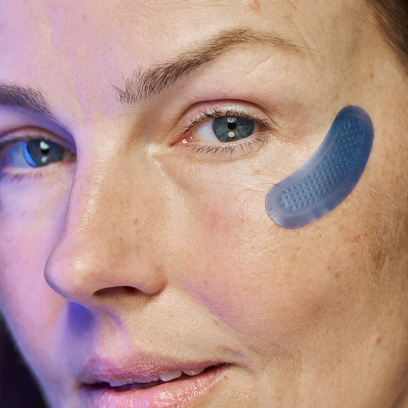 Microneedle Under-Eye Patches