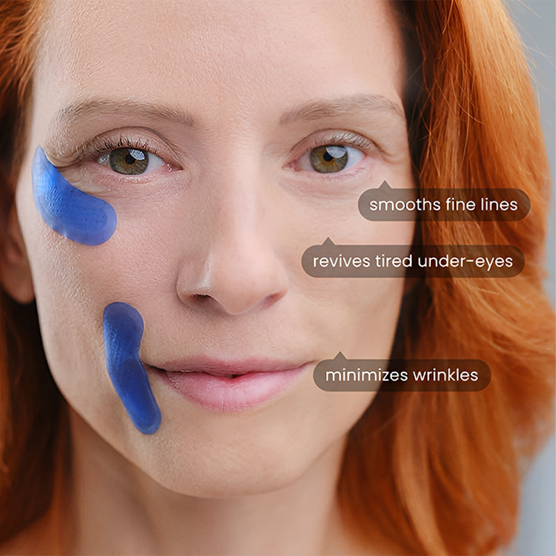 Microneedle Under-Eye Patches