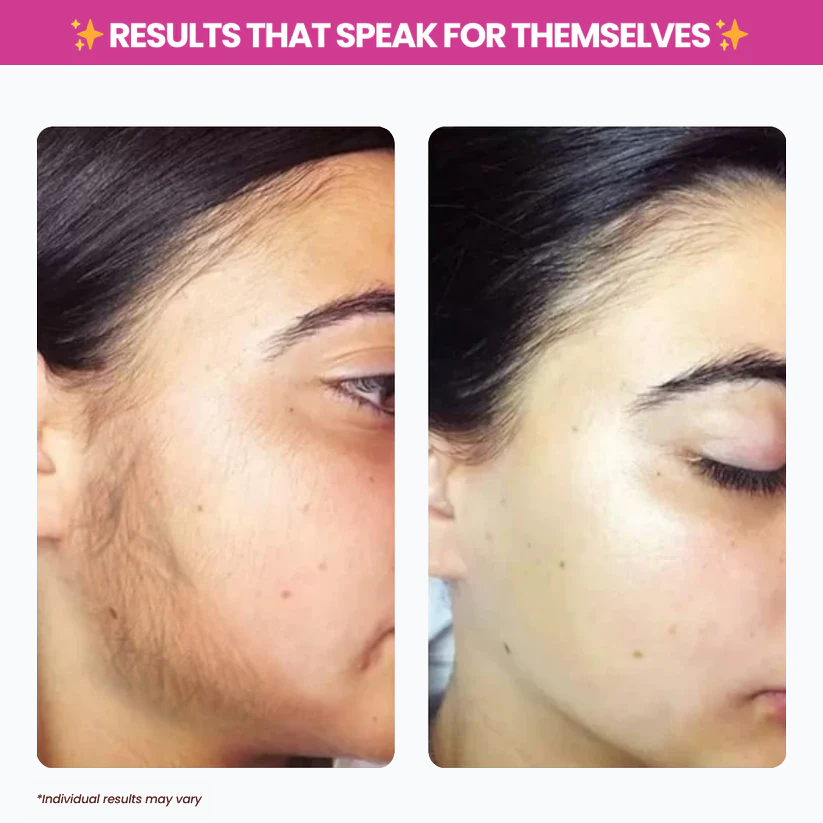 TryAnnie™ Cyperus Rotundus Oil