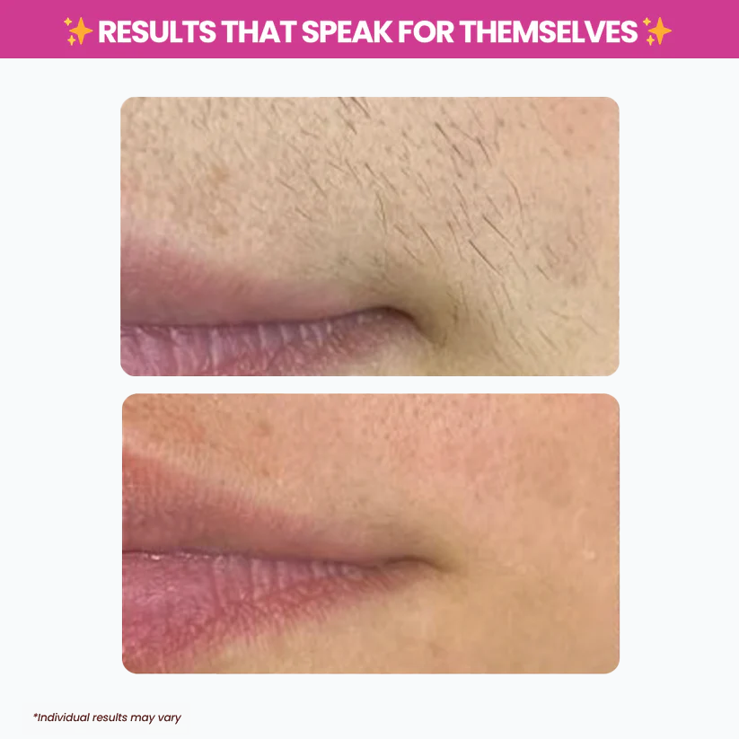 TryAnnie™ Cyperus Rotundus Oil