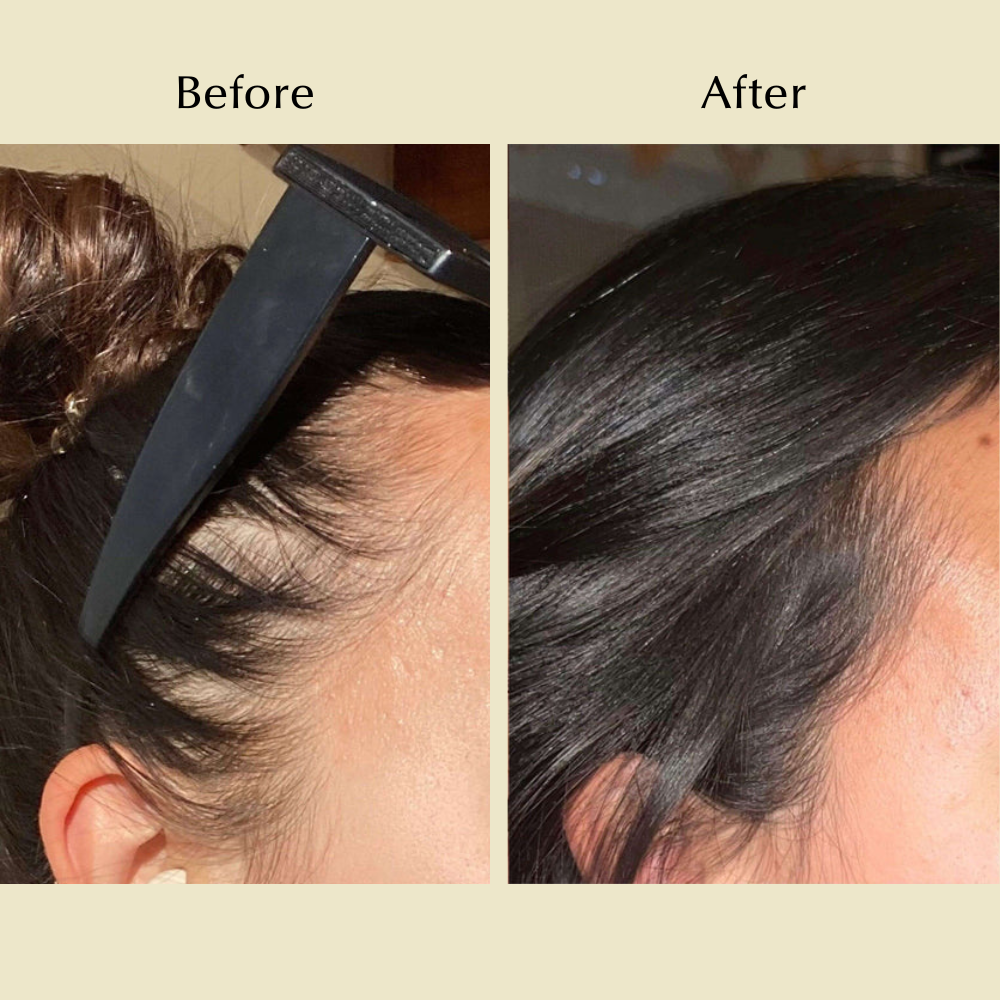 Natural Hair Growth Oil