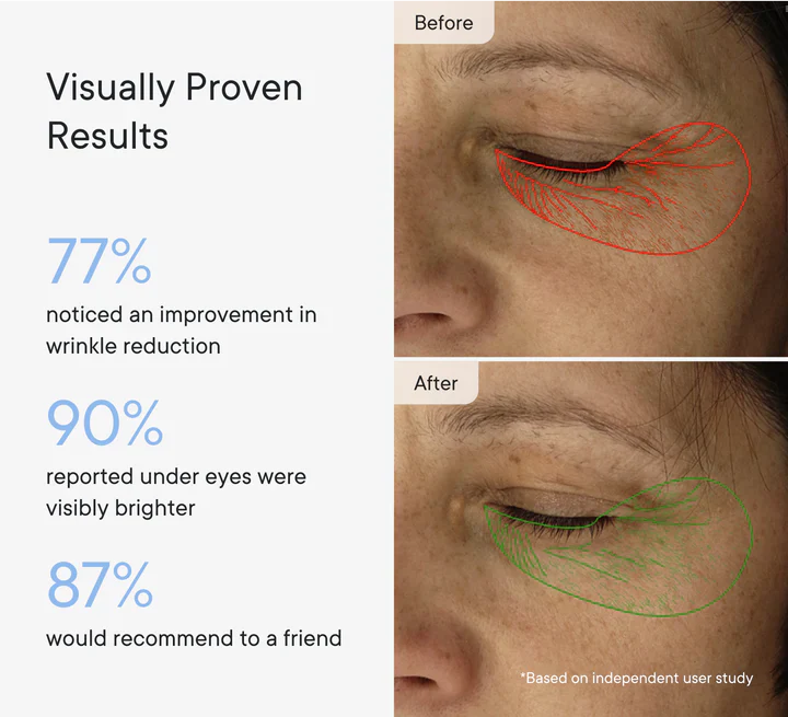 Microneedle Under-Eye Patches