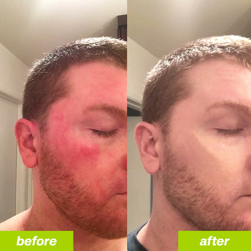 Milk Thistle Liver Detox & Colon Cleanse