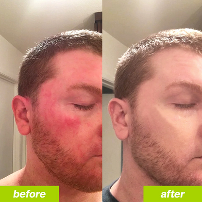 Milk Thistle Liver Detox & Colon Cleanse